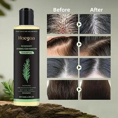 Rosemary Shampoo BoostHair Growth, Control Oil & Dandruff,Soothe Scalp lritation & RestoreShine——ZH