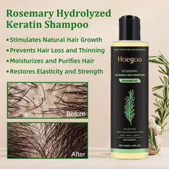 Rosemary Shampoo BoostHair Growth, Control Oil & Dandruff,Soothe Scalp lritation & RestoreShine——ZH