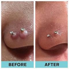 Base Labs Piercing Bump Solution I Keloid Bump Removal - Soothing Essential Oil for Piercing Bumps, Keloids & Scars | Nose, Ears, Body