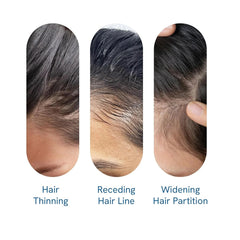 Bodywise Advanced Hair Growth Roll-On Serum | 3% Rosemary | 2% Aminexil | 3% Redensy l 2% Anagain | Precision Scalp Applicator | Paraben & Sulphate Free | Non oily and mess free